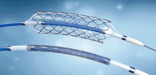 威海創(chuàng  )新創(chuàng  )業(yè)基地心臟支架