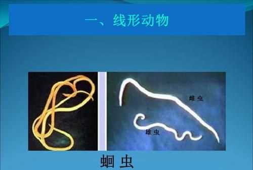 線(xiàn)形動(dòng)物通常寄生在人的哪個(gè)部位