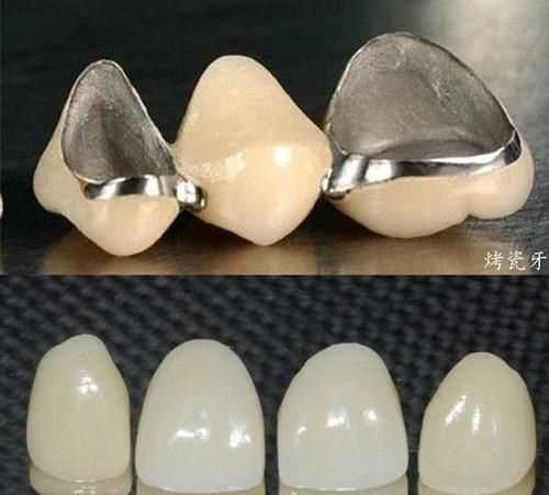 牙音和齒音的區別