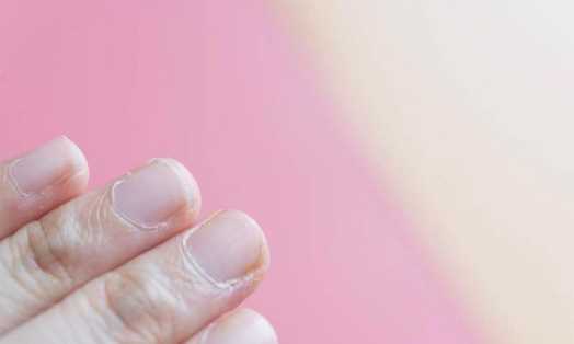 手起倒刺吃什么維生素,手指上長(cháng)倒刺是因為缺乏維生素嗎圖7