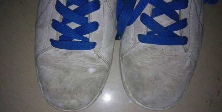 運動(dòng)鞋黃了怎么變白