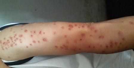 臭蟲(chóng)在水里泡多久才會(huì )死，家里有臭蟲(chóng)，怎么樣才能快速除掉呢？圖4