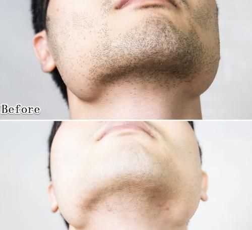 青春期的男生長(cháng)胡子是刮還是剪為好