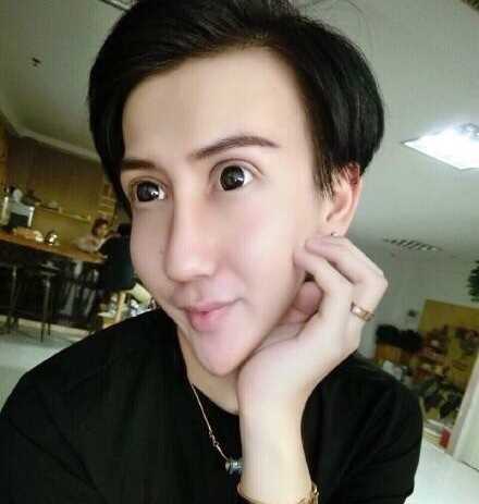 蛇精臉是什么意思?