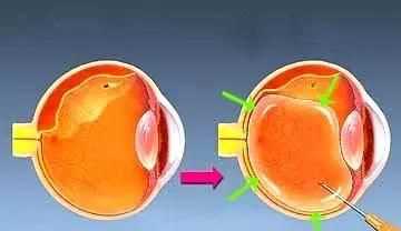 眼鏡可以帶上飛機嗎，五毫升的隱形眼鏡護理液可以隨身帶著(zhù)上飛機嗎？圖7