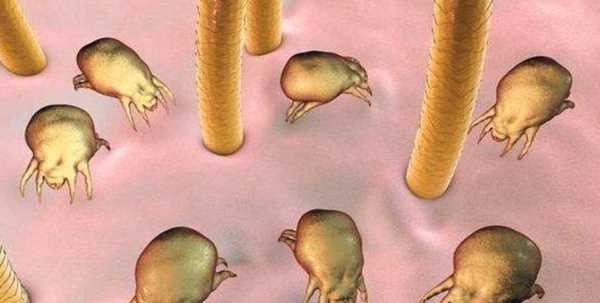 螨蟲(chóng)多少度高溫能殺死,螨蟲(chóng)在多少溫度下能死亡?圖1