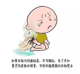 如何預防燙傷安全知識幼兒園