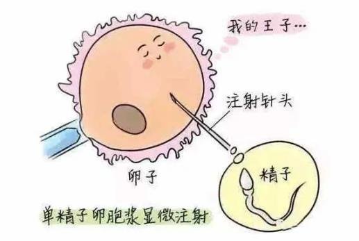 試管嬰兒怎么做的全過(guò)程