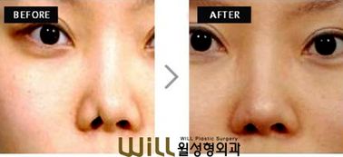 合肥小孩看鼻子醫院有哪些方法