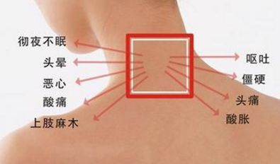 有哪些方法可以緩解頸椎病