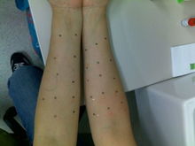 測過(guò)敏源哪些方法準確