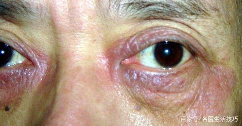 癥狀管理方法有哪些