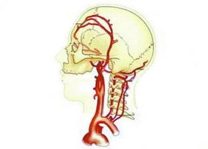 緩解大腦供血不足的方法有哪些