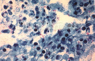 結核分枝桿菌的染色方法有哪些