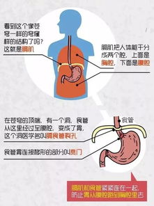 治療食管裂孔疝最好的方法有哪些