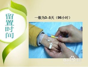 扎好留置針的注意事項