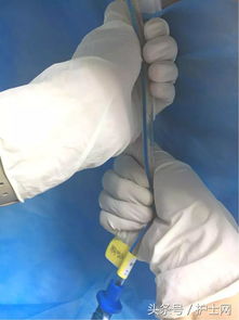 閉式胸膜腔引流護理及注意事項