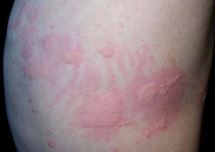 皮膚科,注意事項