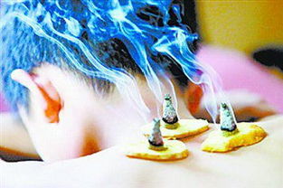 隔姜灸后的注意事項