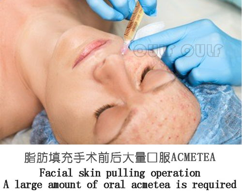 移植后一個(gè)月注意事項