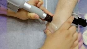 穿跟腱靴注意事項