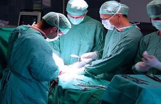 息肉,宮頸,手術(shù)后,注意事項