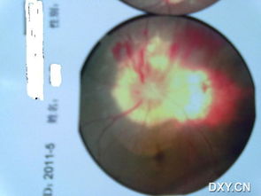 牽?；ňC合癥注意事項