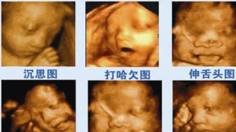 做肝臟彩超注意事項