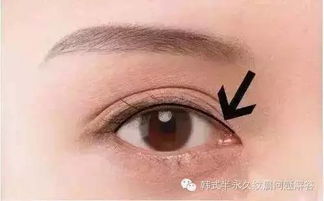 紋眼線(xiàn)后的注意事項,紋眉紋眼線(xiàn)后注意事項,紋眼線(xiàn)后的注意事項有哪些