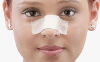 假體隆胸拆線(xiàn)后注意事項,假體隆鼻手術(shù)后注意事項有哪些,假體隆鼻手術(shù)后注意事項