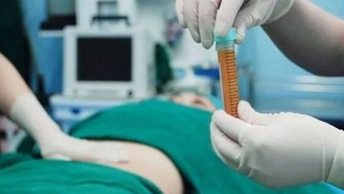 一個(gè)月,移植,注意事項