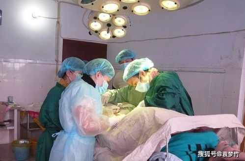 注意事項,剖宮產(chǎn)