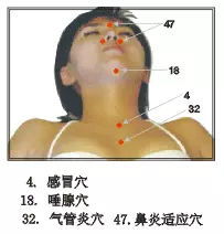 瀉血拔罐注意事項