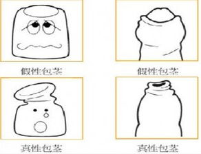 包莖手術(shù)過(guò)后的注意事項是哪些,割完包莖注意事項,男士割包莖注意事項