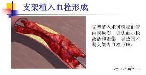 造影,注意事項,醫學(xué)