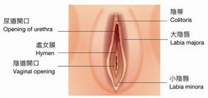 巴氏腺膿腫引流術(shù)術(shù)后注意事項