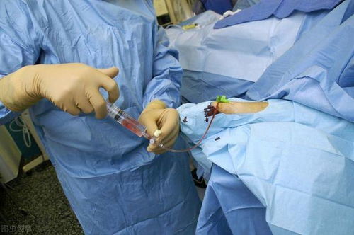 做完增強ct后注意事項,增強ct的流程及注意事項,肝臟增強ct注意事項