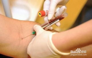 抽血驗過(guò)敏源注意事項