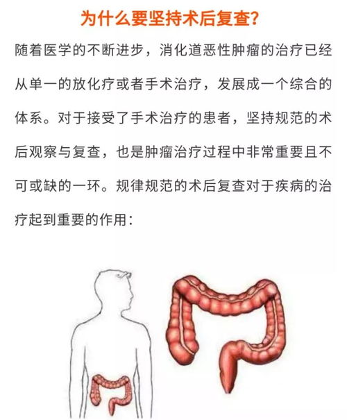 結腸灌洗的方法和注意事項,中藥全結腸灌洗注意事項,結腸esd術(shù)后注意事項