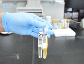 尿標本收集的注意事項,尿標本的收集和保存注意事項,尿標本采集的注意事項