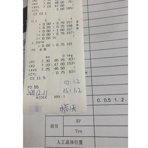 眼睛做完icl手術(shù)后注意事項,icl手術(shù)后飲食注意事項,做完宮腔鏡手術(shù)后注意事項