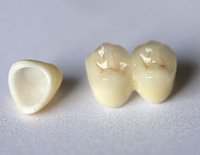 戴牙冠后注意事項,做了臨時(shí)牙冠注意事項,裝牙冠后注意事項