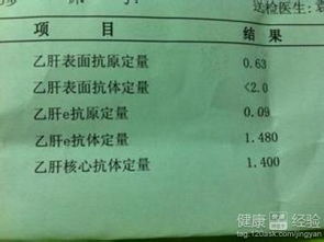 做乙肝五項檢查注意事項,做乙肝檢查前注意事項,乙肝五項抽血前注意事項