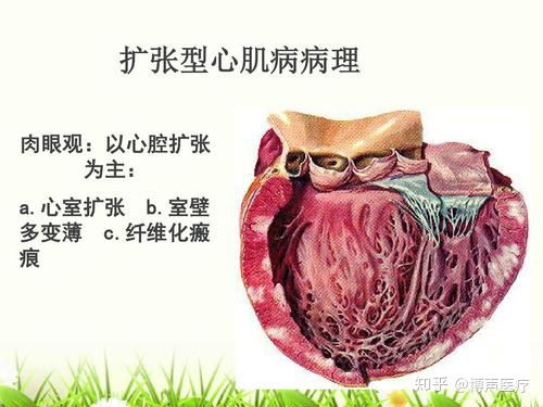 心臟球囊擴張術(shù)后注意事項,心臟支架術(shù)后注意事項,心臟支架十大注意事項