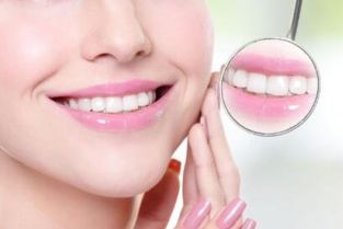 烤瓷牙按完之后注意事項,烤瓷牙鑲牙后注意事項,烤瓷牙的注意事項