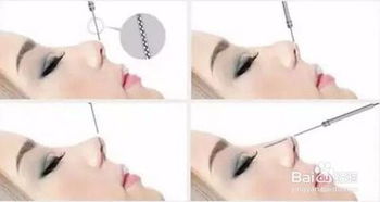 做好線(xiàn)雕鼻子注意事項