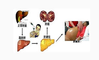 護理梅毒患者注意事項,梅毒患者日常生活注意事項,梅毒患者平時(shí)注意事項