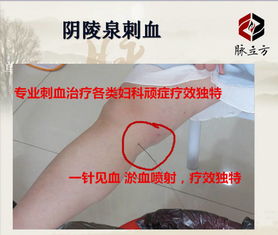 火針療法的禁忌癥及注意事項,刺血療法的注意事項及禁忌癥,刺血療法后的注意事項