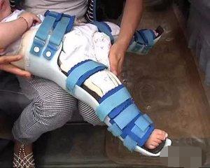 兒童腳趾骨折后注意事項,腳趾骨折護理注意事項,腳趾骨折術(shù)后注意事項