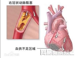 擴張,注意事項,心臟